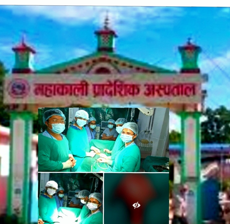 महाकाली प्रादेशिक अस्पतालका पाठेघरकाे सफल सल्यक्रिया ।