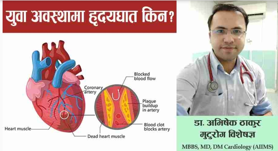 युवा अवस्थामा किन हुन्छ हृदयधात ? डा अभिषेक ठाकुर, मुटुराेग बिशेषज्ञ